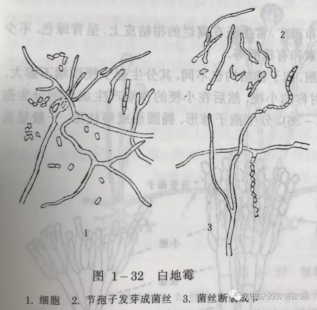 黑根霉显微镜下手绘图图片