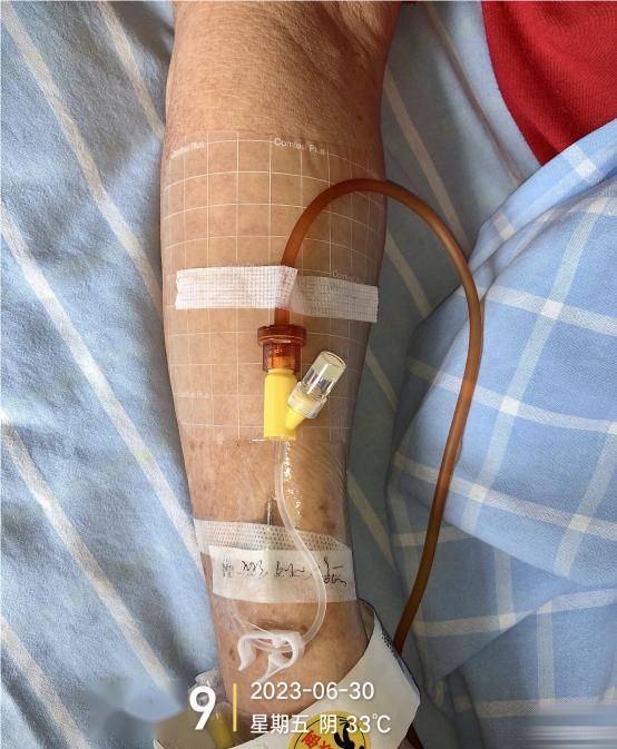 留置针遇到这 3 个问题,拔还是不拔?_静脉_临床_时间