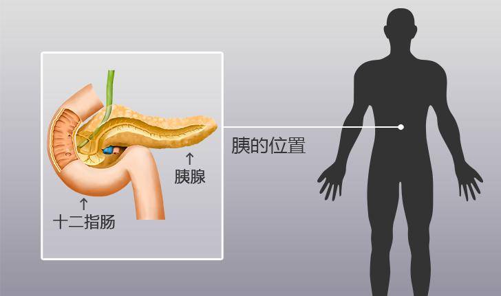 胰腺炎在哪个位置图片