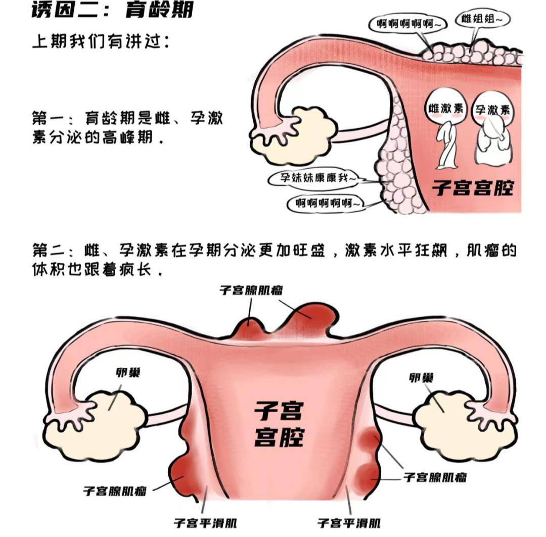 子宫长啥样图片