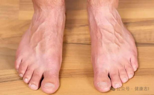 脚血管堵塞怎么治疗图片
