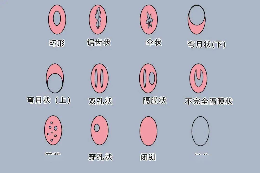 拒绝"私密羞耻" ,有些秘密,我们悄悄说!_整形_女性_生活