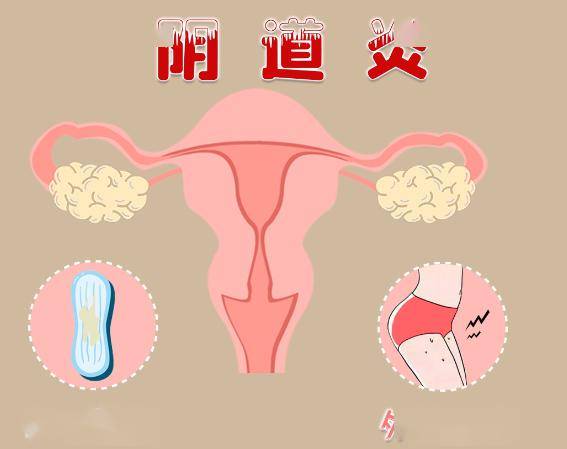 周口_外阴_用药