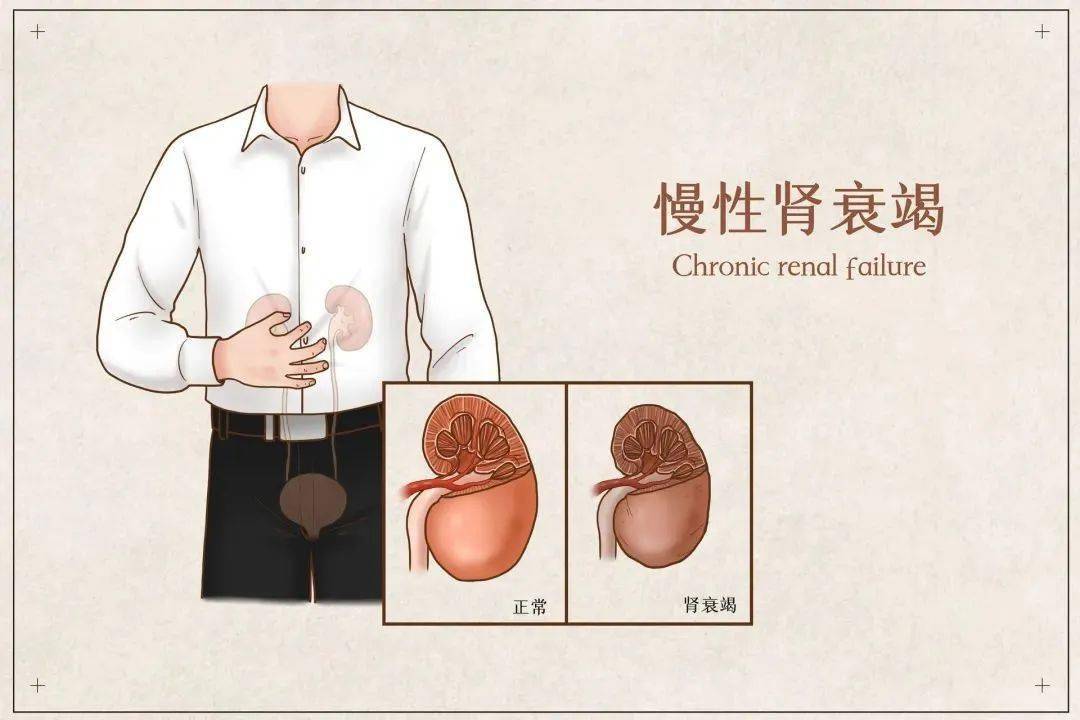 世界肾脏日|"沉默杀手"慢性肾脏病如何防御?