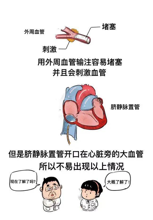 脐静脉注射术演示图图片
