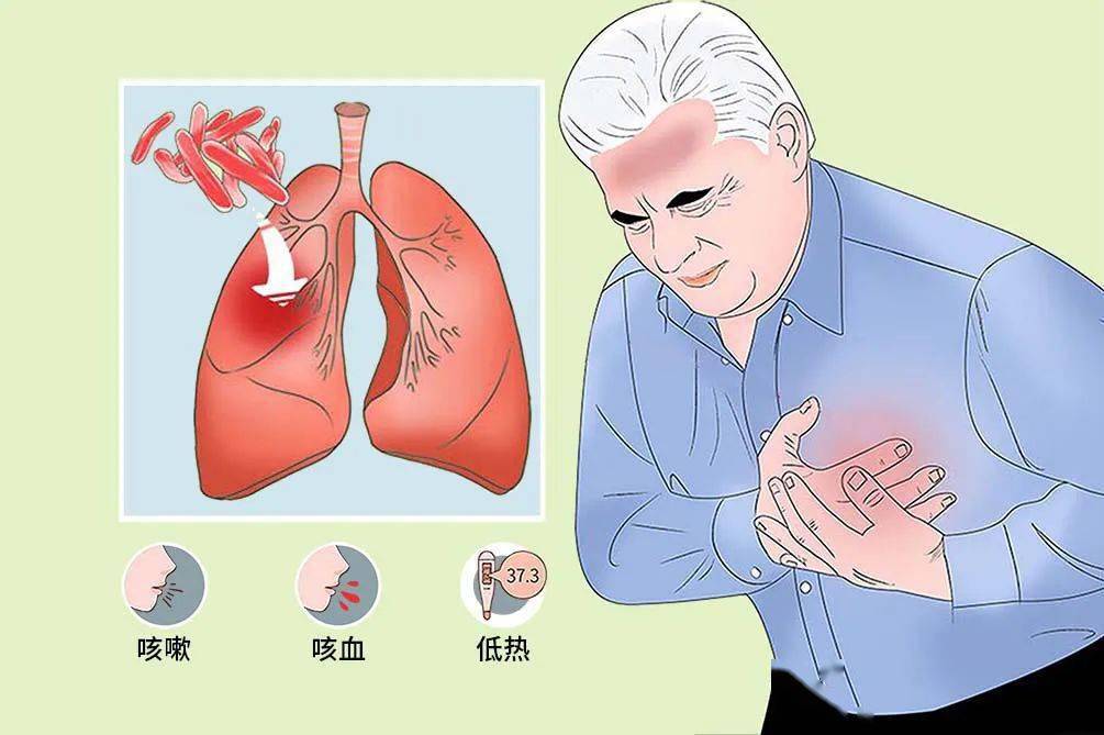 减轻肺结核患者负担,提高患者治疗依从性及治愈率,国家推行了肺结核治