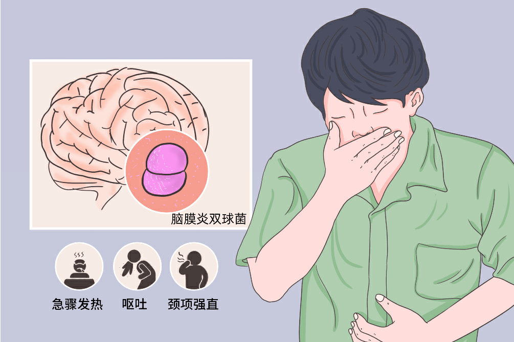 流行性脑脊髓膜炎主要表现为发热,头痛,呕吐,皮肤瘀点,颈项强直,可