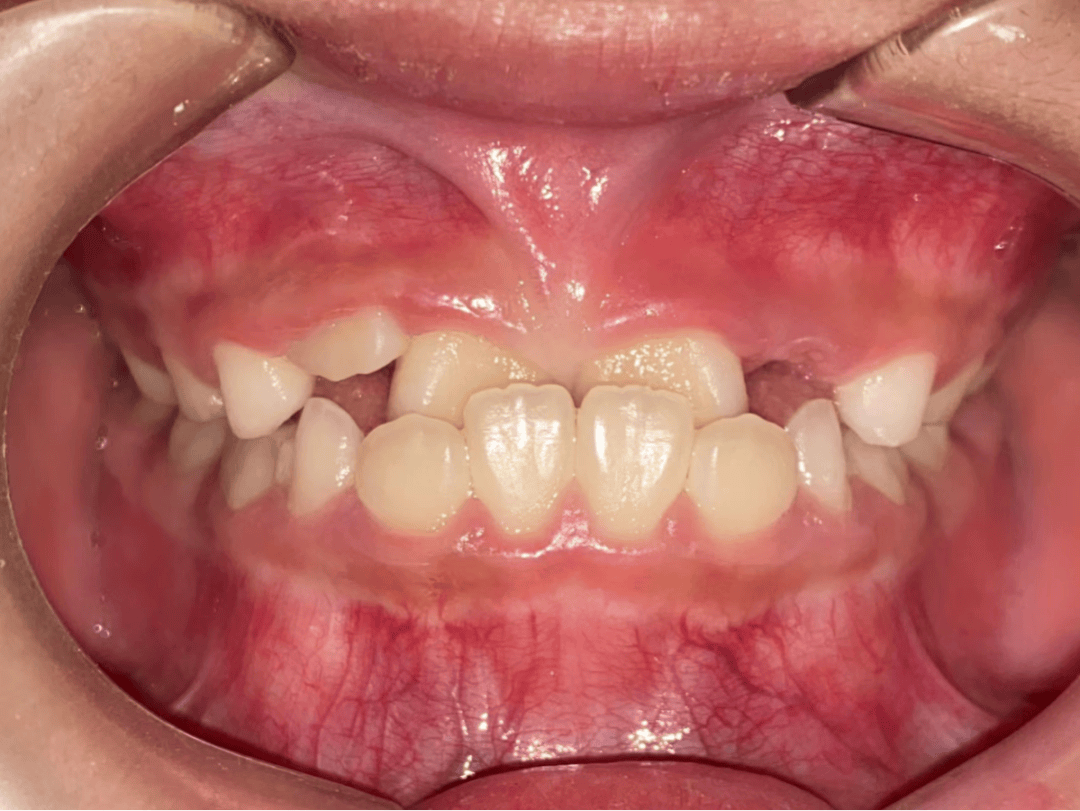 口臭洁牙老年口腔中医口腔门诊即将开诊雁江区人民医院呵护您的牙齿