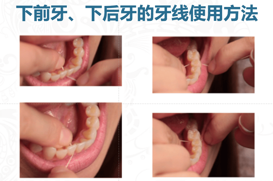 这种病竟然追上了90后 00后