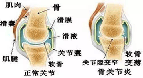 健康科普且行且珍膝你的关节还好吗