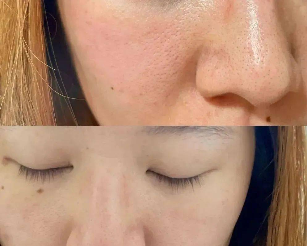 脸比你想得,更容易变黄_皮肤_精华_效果