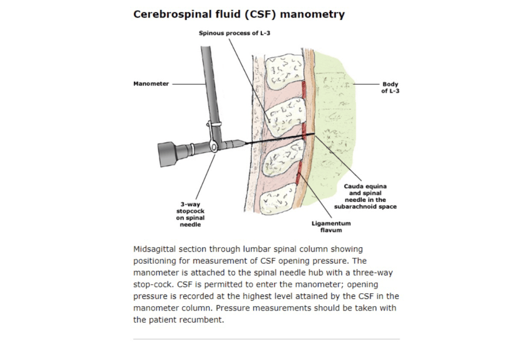 君安中英文编辑部第24期脑脊液检查美国指南