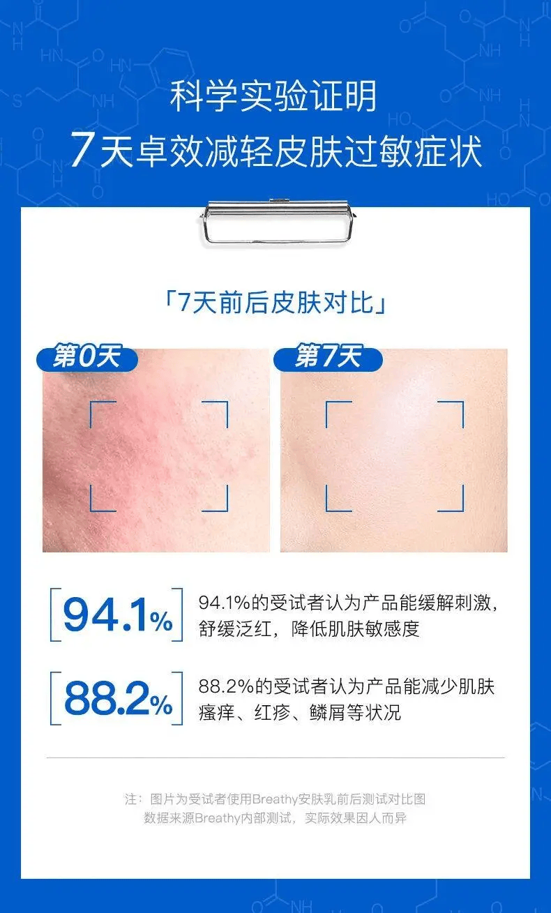 过敏季刚需干痒人士必备的舒敏安肤乳快速止痒温和不刺激