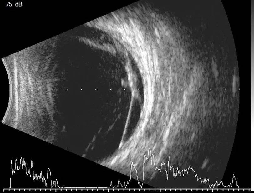二维B超图片