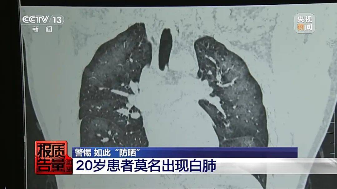 使用不慎引发白肺还可能变喷火枪这个神器要当心