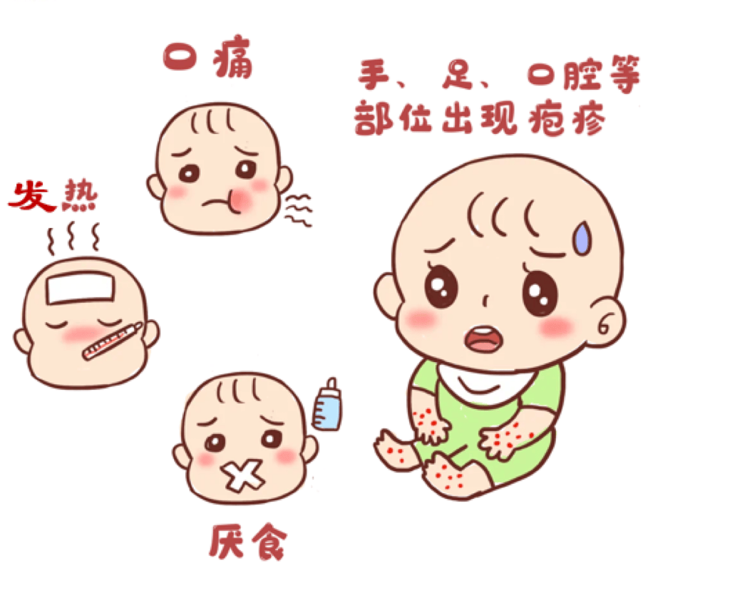 科普全体家长手足口病高发季来临这些健康知识一定要知道
