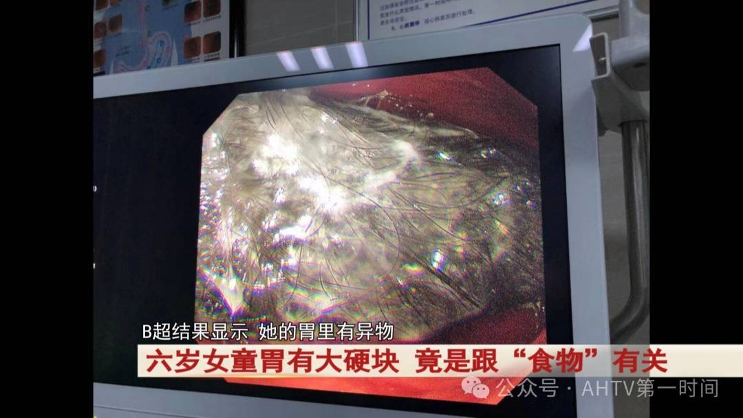 潘祝彬_头发_医生