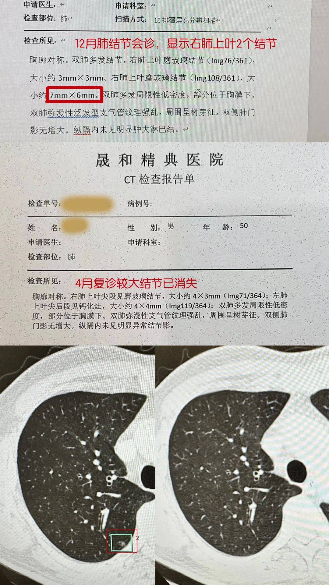 ct报告单图片 电子版图片