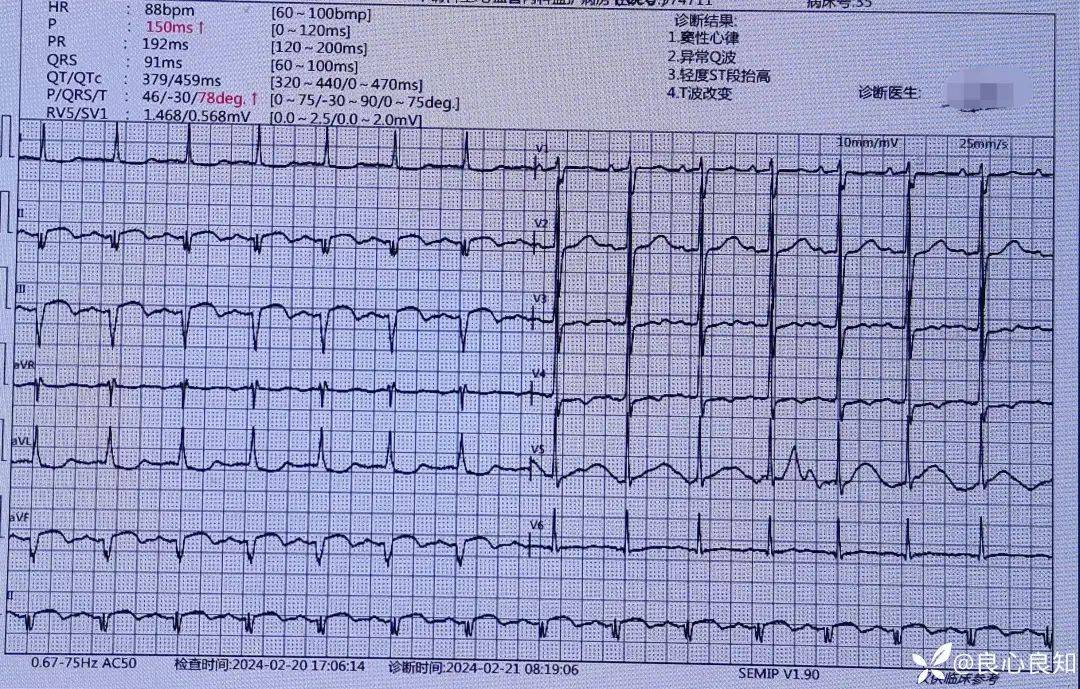 最新版心电图危急值图片