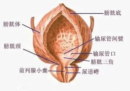 腺性膀胱炎发病原因与下尿路梗阻,泌尿系统慢性感染,泌尿系结石,异物