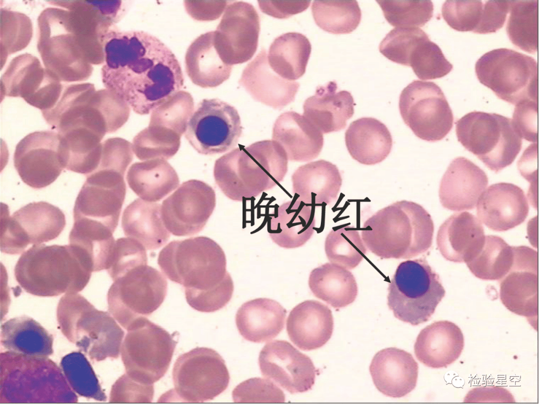 检验形态学图谱图片