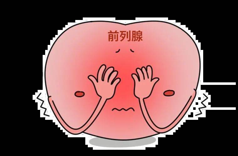 psa升高就是前列腺癌吗?