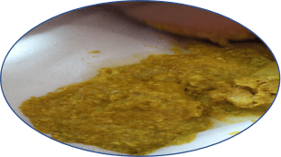 健康科普|关于宝宝大便的各种疑问,99%的新手爸妈都收藏了