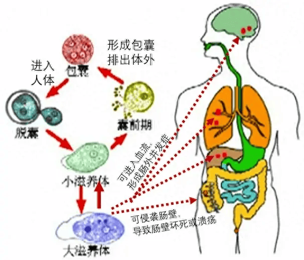 果酱样粘液血便？可能要小心阿米巴痢疾！_症状_组织_患者