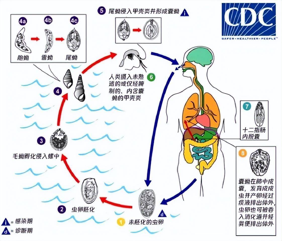 姜片虫感染图片