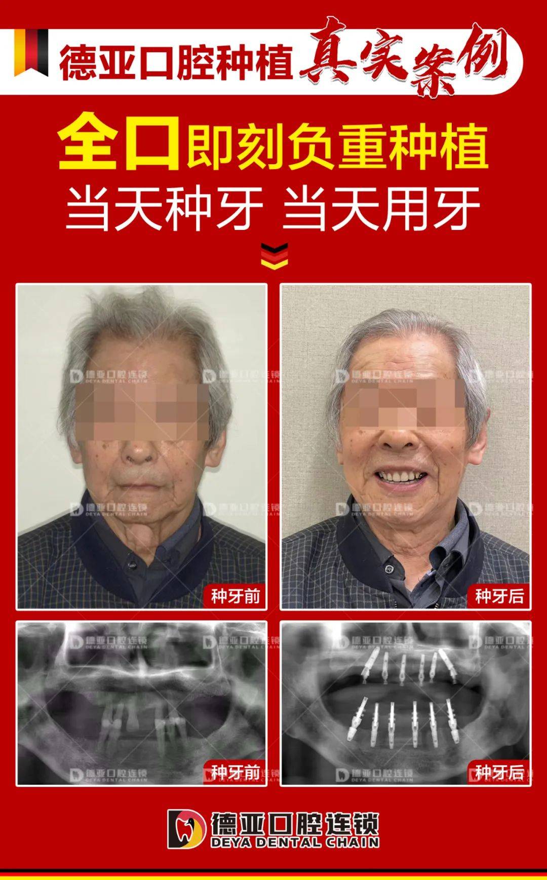 缺牙,牙不齐费用省了!24:00申报结束_牙齿_口腔_补贴