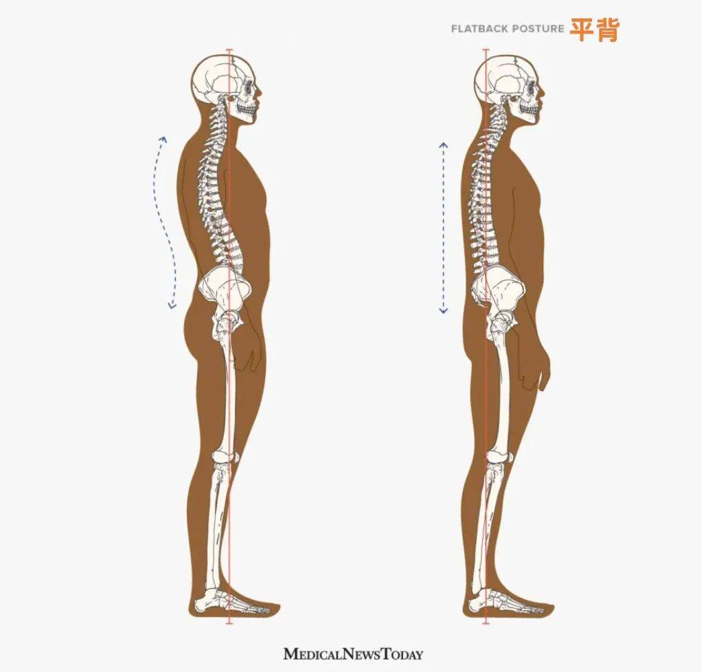 世界脊柱健康日丨关爱脊柱,呵护健康