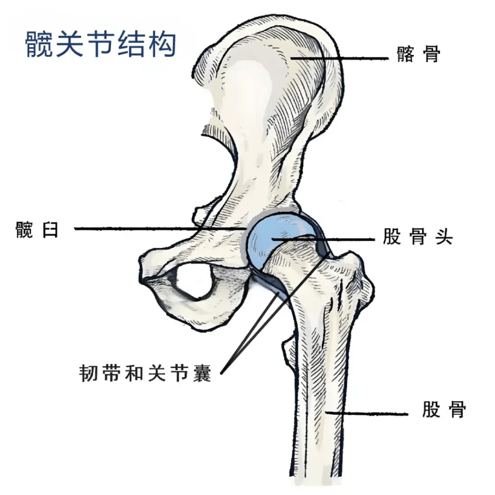 股骨头位于大腿骨的上端;髋臼是骨盆骨前下方的凹形结构,与股骨头