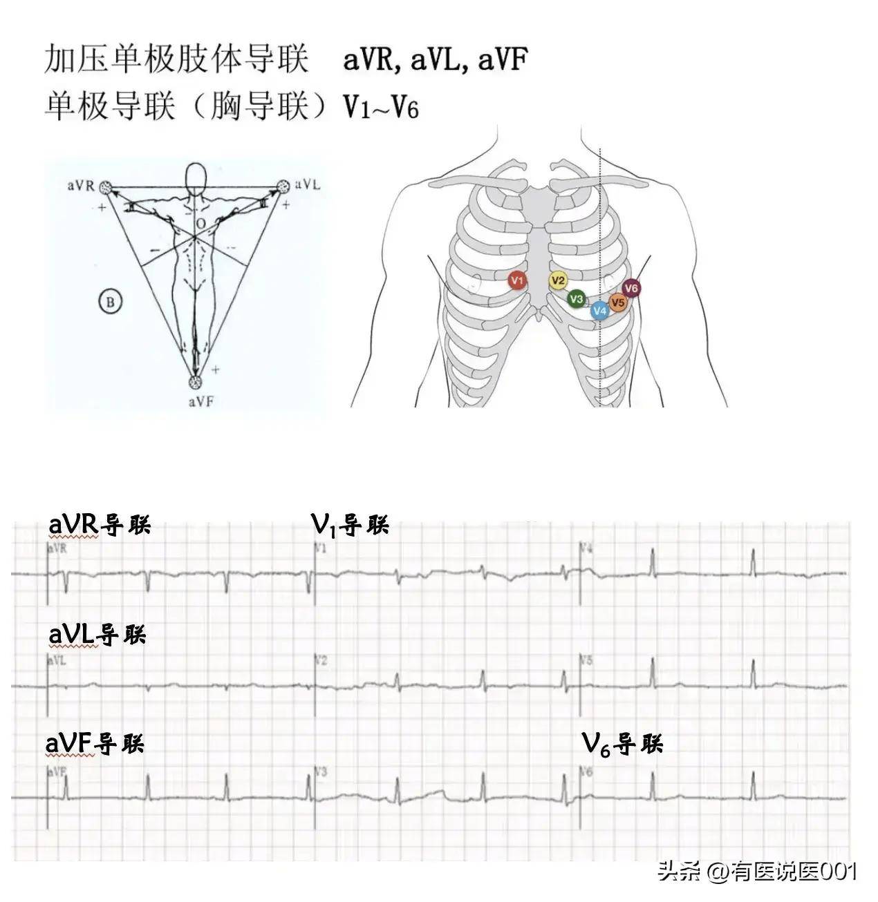 医生教你简单快速看心电图