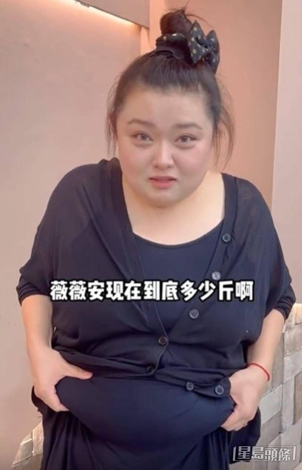 照片中的陈嘉佳终于再见到腰,开始减肥后首先瘦的双腿更加纤幼