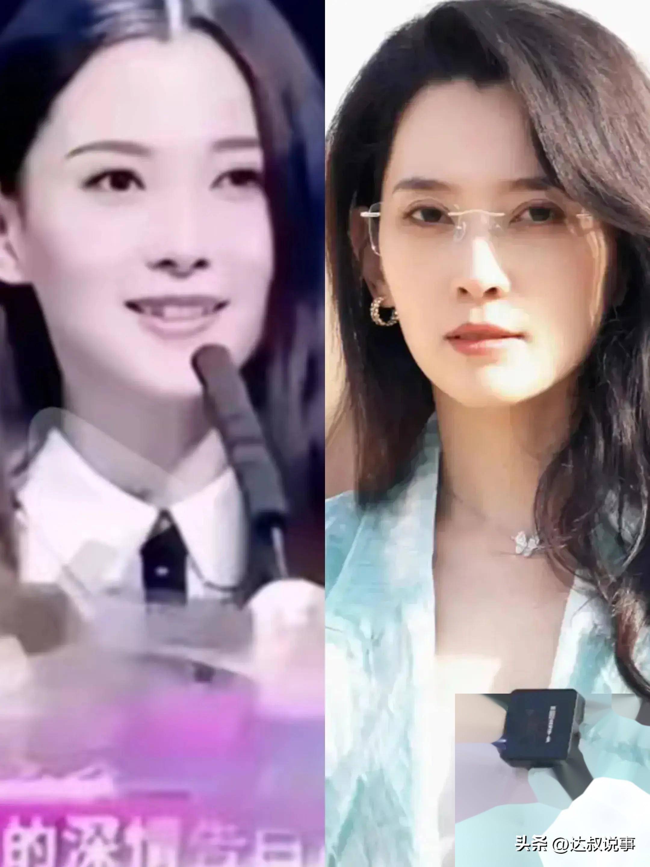 森林北(李巧)到底有没有整容?看她前后的照片对比就知道答案了_气质_因为_牙齿