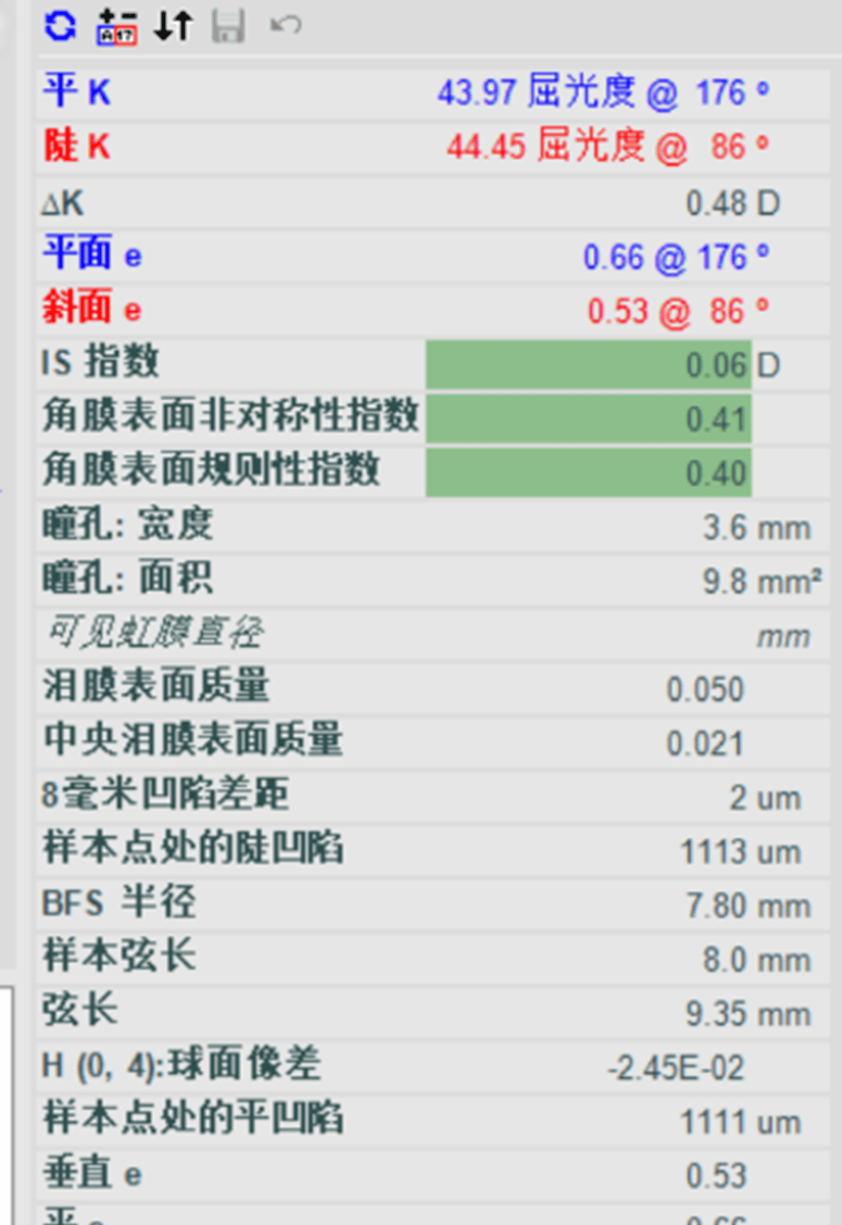 角膜曲率正常范围图片