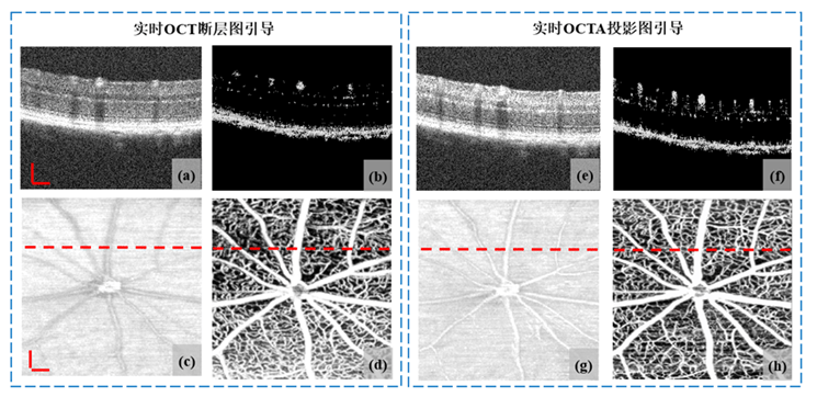 oct视网膜分层结构图图片