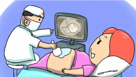 怀孕孕囊b超图图片