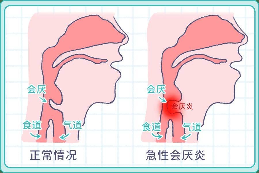 会厌在什么位置图片图片