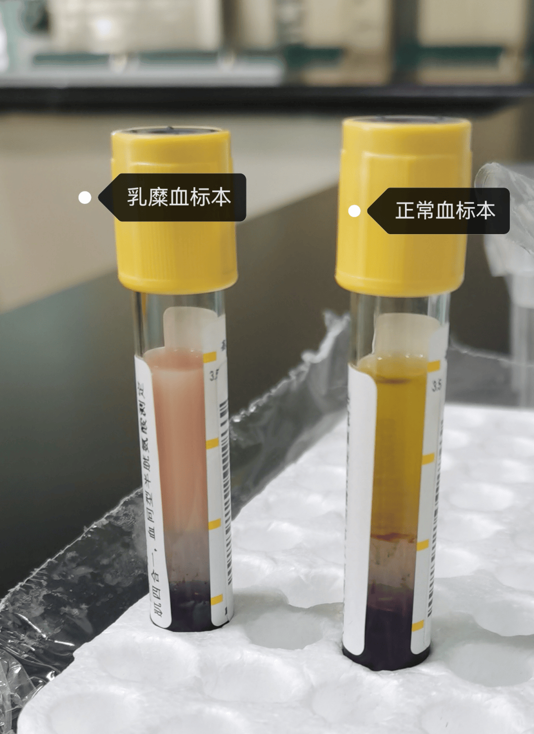 食物_血浆_现象