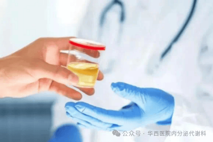 24小时尿标本,您留对了吗?