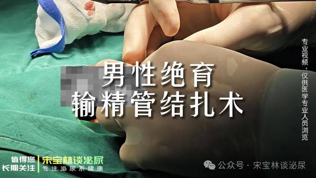 055男性绝育-输精管结扎术（手术视频）