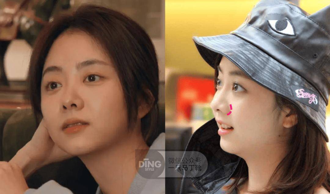 比如谭松韵,正侧面都能看出鼻翼基底有点凹陷,鼻梁也矮矮钝钝的,但和