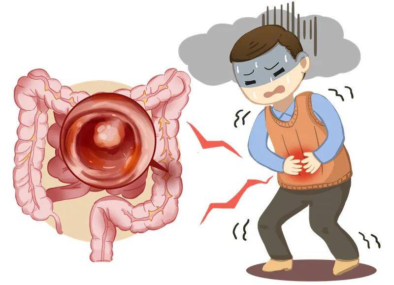 检查_肠道_疾病