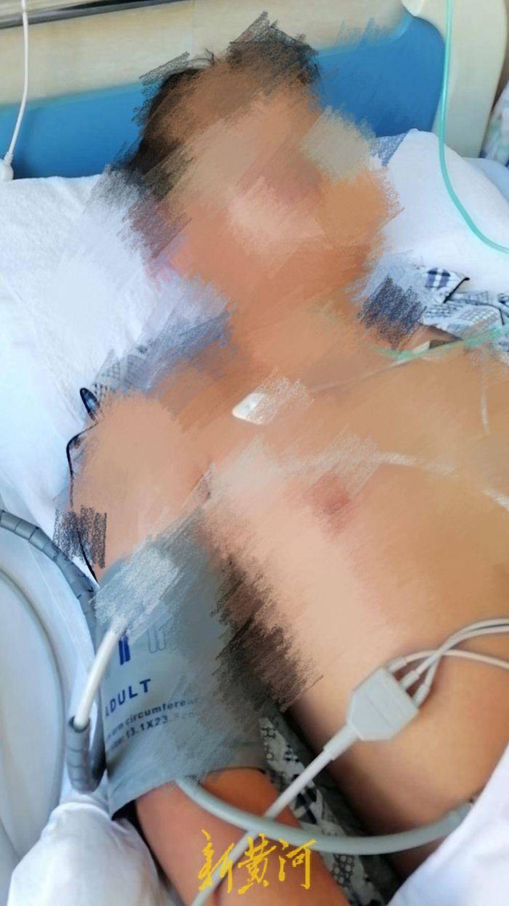 14岁初中生课堂“嗑药”致昏迷进ICU-初中生吃药期间自残正常吗