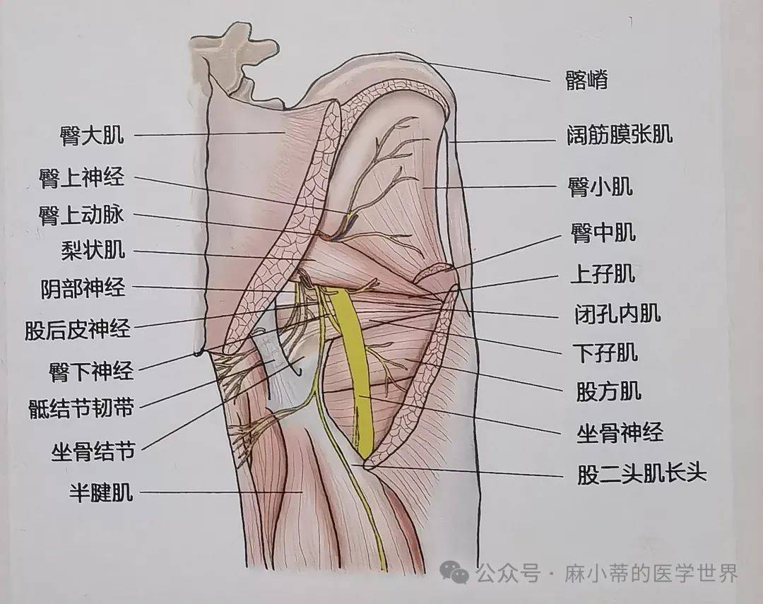 屁股痛,梨状肌综合征?查查闭孔内肌再说?