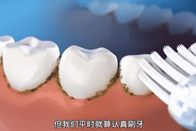 360°包裹式,逼出10年老牙渍,牙黄,口臭byebye!