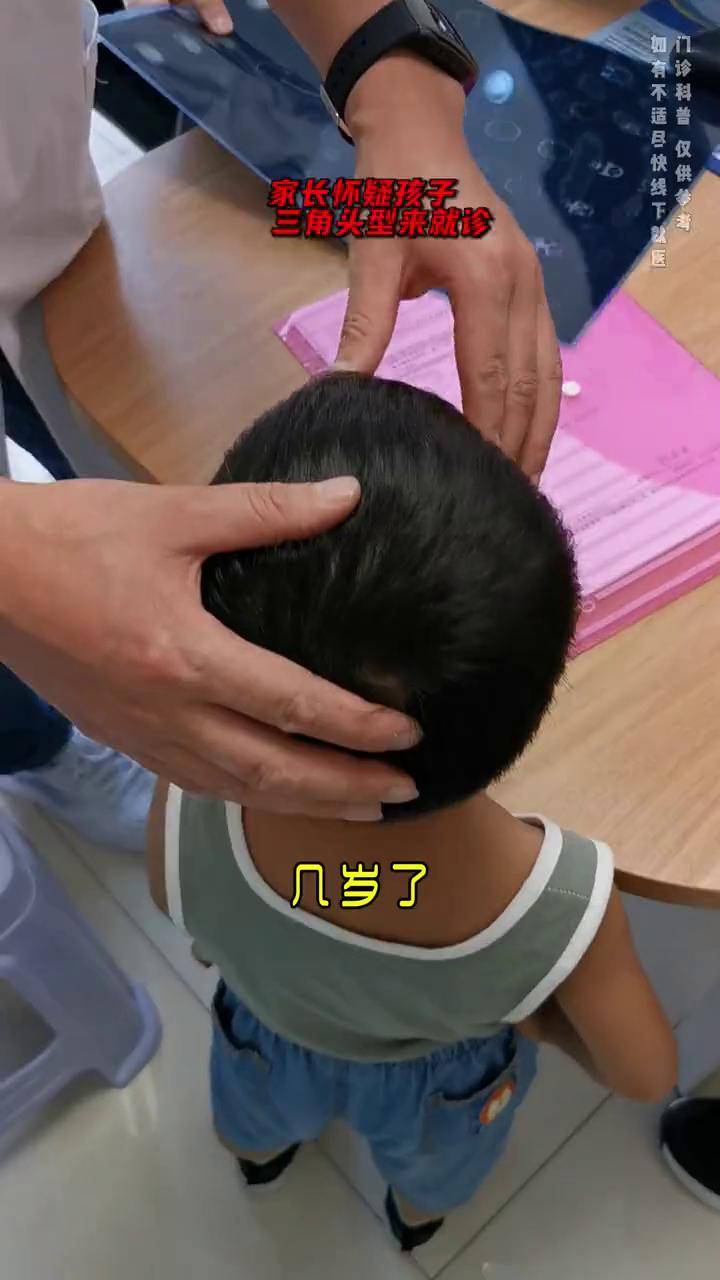 四岁孩子额头尖尖的颅缝早闭但不严重观察就好颅缝早闭额头尖儿童脑科