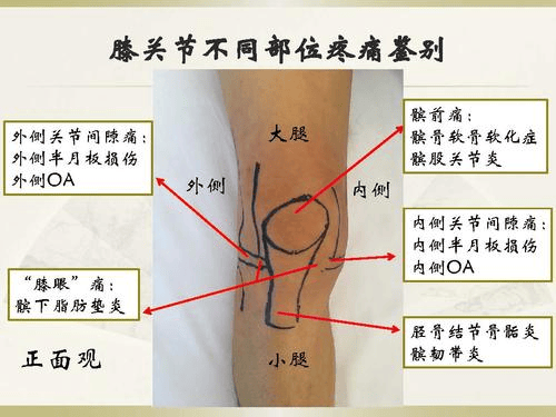 右膝盖结构图图片