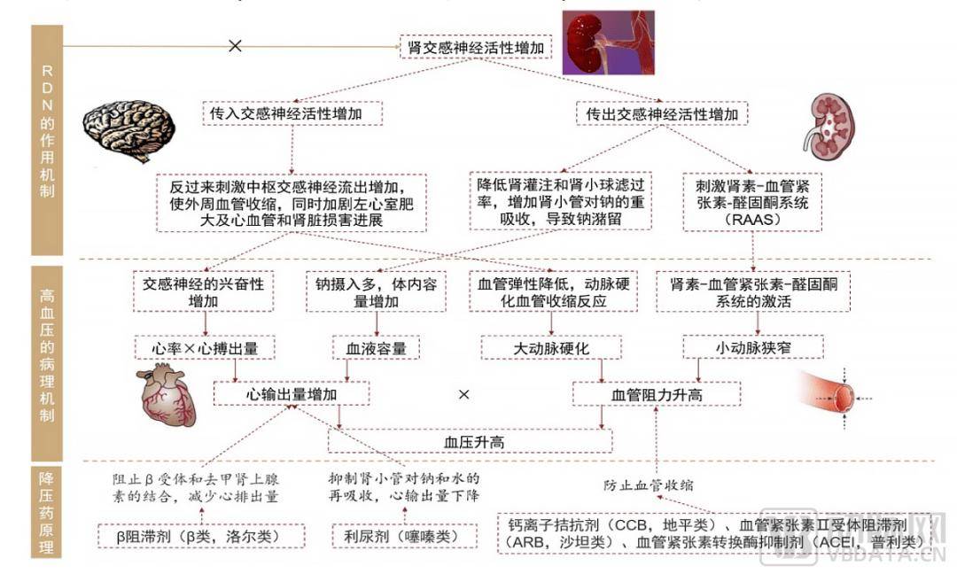 交感神经活性增强及持续存在是难治性高血压重要的发病机制之一